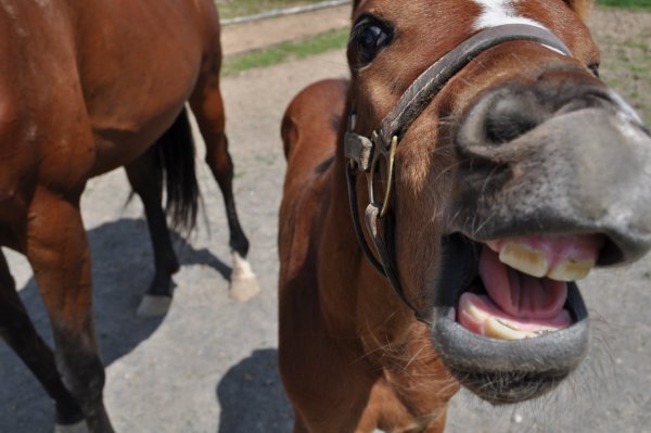 radar teeth